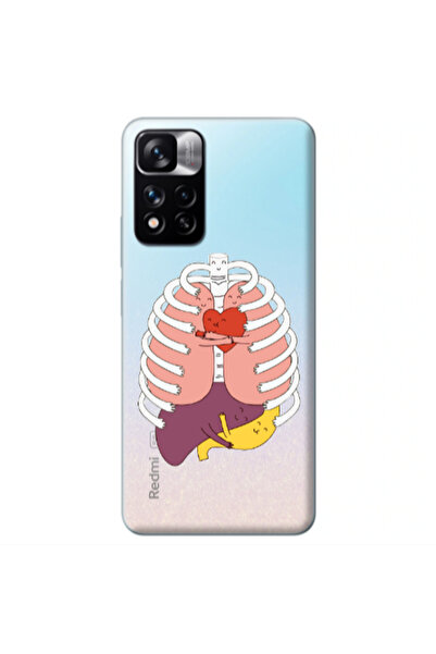 Other Xiaomi Redmi Note 11s 5G Anatomy Transparent Silicone TPU Θήκη