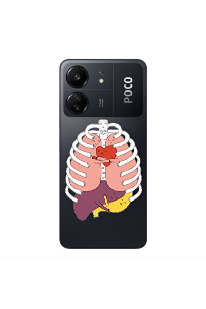Other Xiaomi Poco C65 Anatomy Transparent Silicone TPU Θήκη