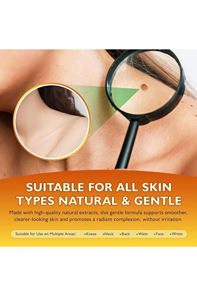 ELAIMEI Bee Venom Cream Skin Wart & Tag Remover, Bee Venom Skin Treatment Cream for Tag and Spot Removal, Bo