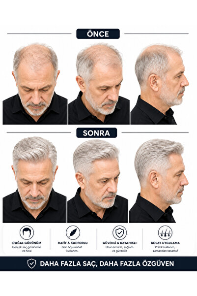 Hairtime Erkek Beyaz Protez Saç – Doğal Görünümlü, Hafif ve Konforlu Saç Sistemi