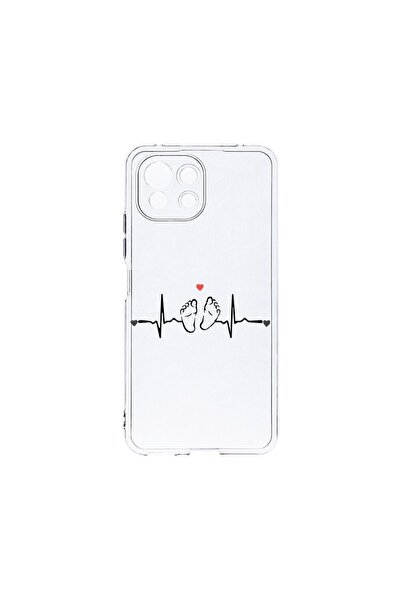 bestcase Husa BestCase¬Æ Clear Silicon 2MM, Compatibila Cu Xiaomi Mi 11 Lite,...