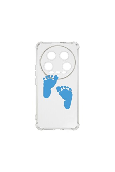 bestcase ¬Æ Husa Anti Shock 1.5MM, Compatibila Cu Xiaomi 14 Ultra, Boy Feet P...