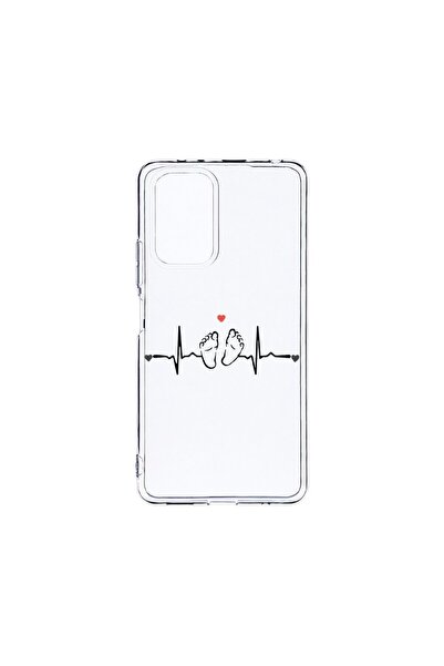 bestcase ¬Æ Husa Clear Silicon 2MM, Compatibila Cu Motorola Moto G85, My Litt...