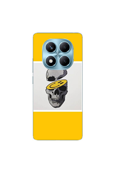 Other Xiaomi Redmi Note 14 Pro Smiley dry head Transparent Silicone TPU Θήκη