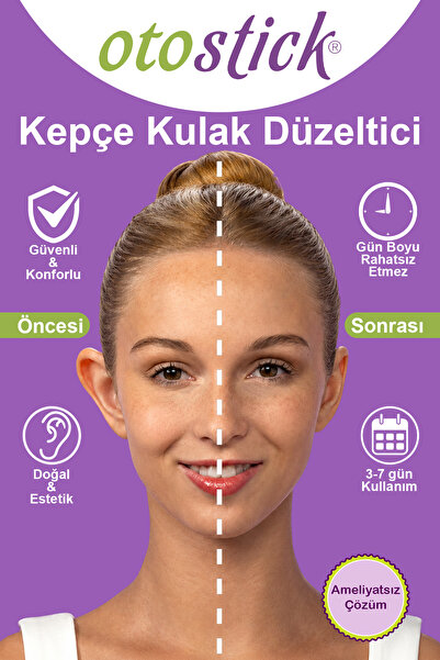Otostick Kepçe Kulak Düzeltici Yetişkin