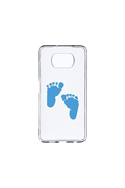 bestcase Husa BestCase¬Æ Clear Silicon 2MM, Compatibila Cu Xiaomi Poco X3 Pro...