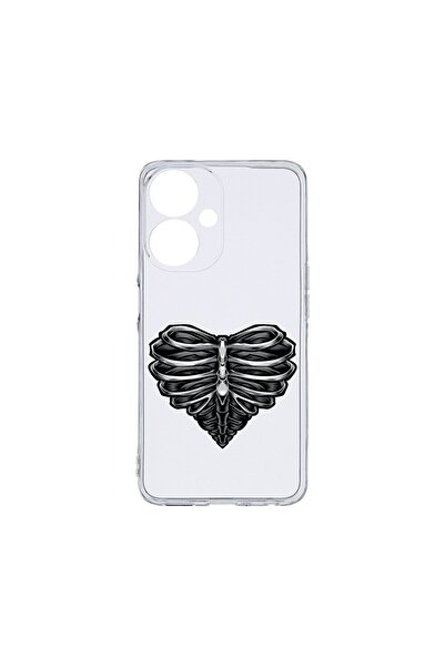 bestcase Husa BestCase¬Æ Clear Silicon, Compatibila Cu Honor X7b, Skeleton He...