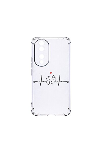 bestcase Αντικραδασμική Θήκη 1.5MM, Συμβατή με Honor 90, My Little Love, Αντο...