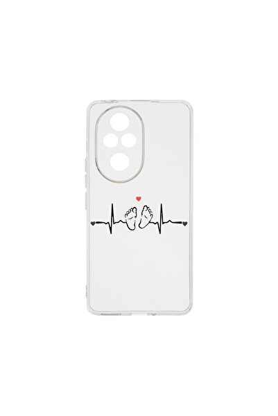 bestcase Θήκη Διαφανής Σιλικόνης 2MM, Συμβατή με Honor 200, My Little Love, A...