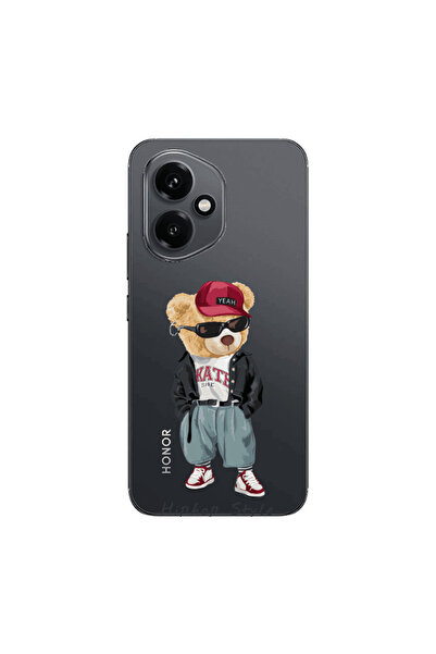 Other Honor Magic 400 Hip hop style Transparent Silicone TPU Θήκη