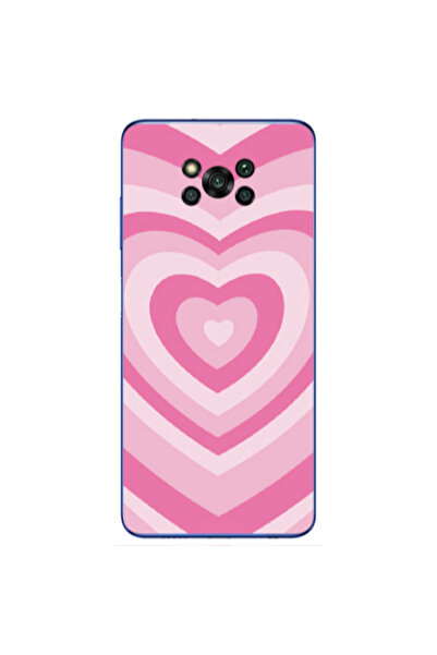 Other Xiaomi Poco X3 /X3 Pro Hypnotizing Transparent Silicone TPU Θήκη