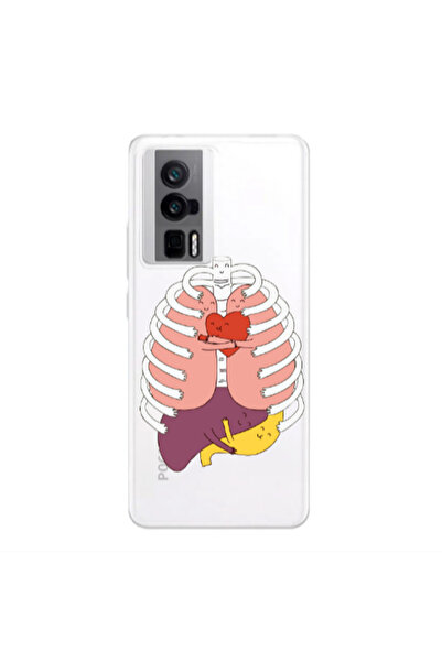 Other Xiaomi Poco F5 Pro Anatomy Transparent Silicone TPU Θήκη