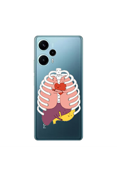 Other Xiaomi Poco F5 Anatomy Transparent Silicone TPU Θήκη