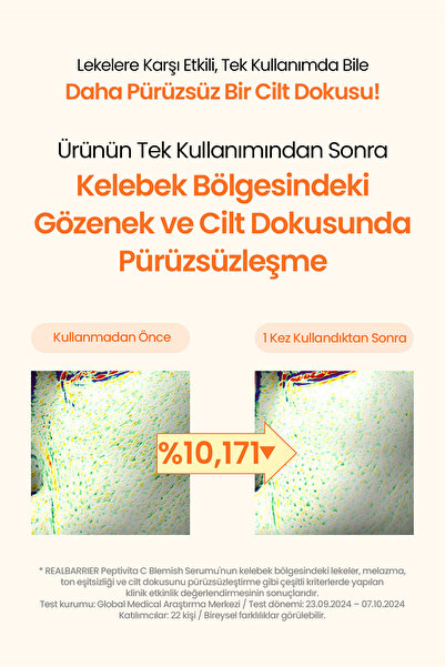 Real Barrier Leke Karşıtı Sıkı Görünüm Sunan Aydınlatıcı C Vitamini Serumu REALBARRIER Peptivita C Blemish Serum