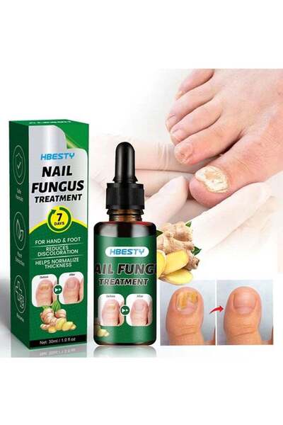 HBESTY 7 Days Nail Fungus Treatment, Moisturize the Cuticle & Strengthen Nail...