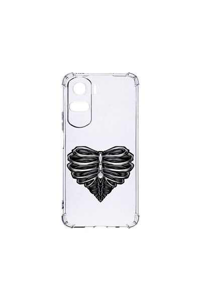 bestcase Husa BestCase¬Æ Anti Shock 1.5MM, Compatibila Cu Honor 90 Lite, Skel...