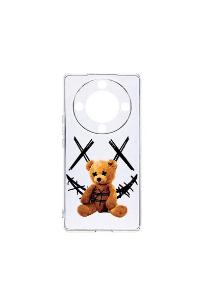 bestcase Θήκη Διαφανής Σιλικόνη 2MM, Συμβατή με Honor Magic6 Lite / X9b / X50...