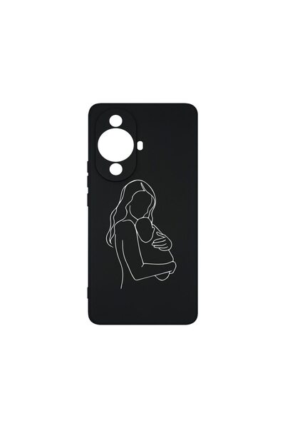 bestcase Θήκη Υψηλής Ποιότητας από Υγρή Σιλικόνη, Συμβατή με Huawei nova 11, ...