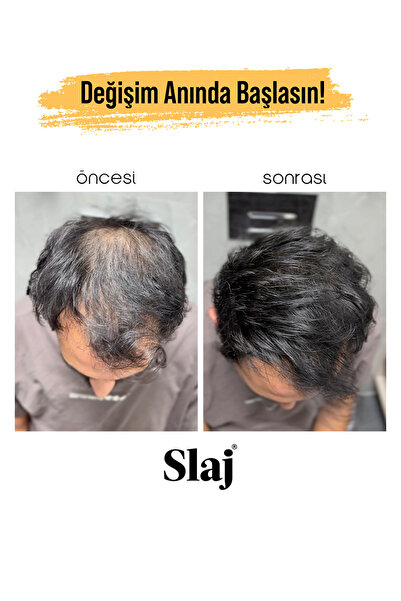 Slaj Saç Kapatıcı Seyrek Saç Kapatıcı 50ml x 2 Adet