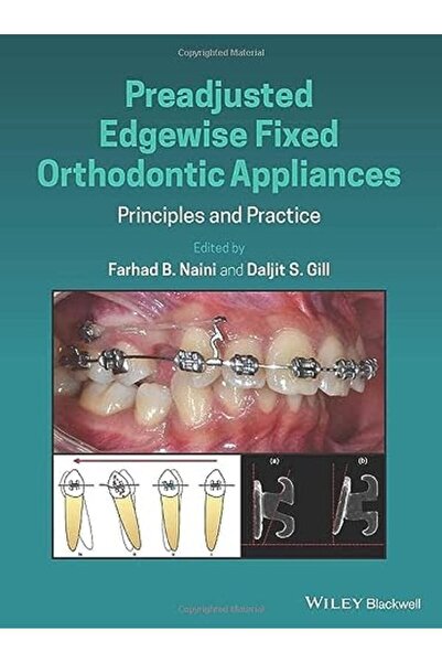 John Wiley & Sons Inc Preadjusted Edgewise Fixed Orthodontic Appliances Princ...