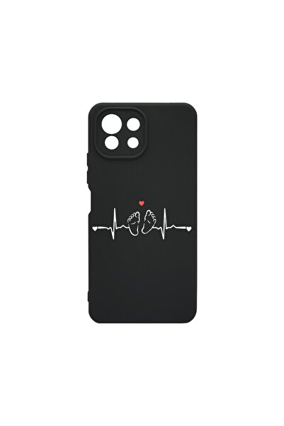 bestcase Husa BestCase¬Æ Premium Liquid Silicon, Compatibila Cu Xiaomi Mi 11 ...