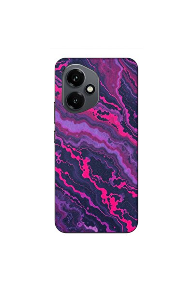 OEM Husa compatibila cu Honor 400 Silicon Gel Tpu Model Midnight Rose Marble