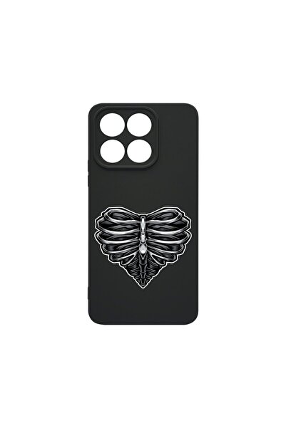 bestcase Husa BestCase¬Æ Premium Liquid Silicon, Compatibila Cu Honor X8a, Sk...