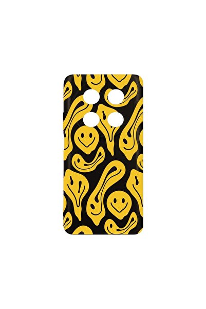 bestcase Λεπτή Θήκη Σιλικόνης 0.8MM, Συμβατή με Huawei Nova 12i, Κίτρινο Αισχ...