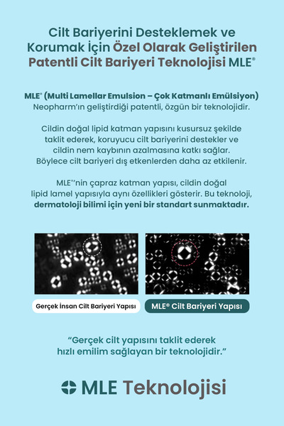 Atopalm Hassas Cildi Nemlendirerek Rahatlatan ve Ferahlık Hissi Sunan Jel Losyon Soothing Gel Lotion