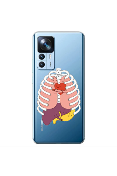 Other Xiaomi Mi 12T Anatomy Transparent Silicone TPU Θήκη