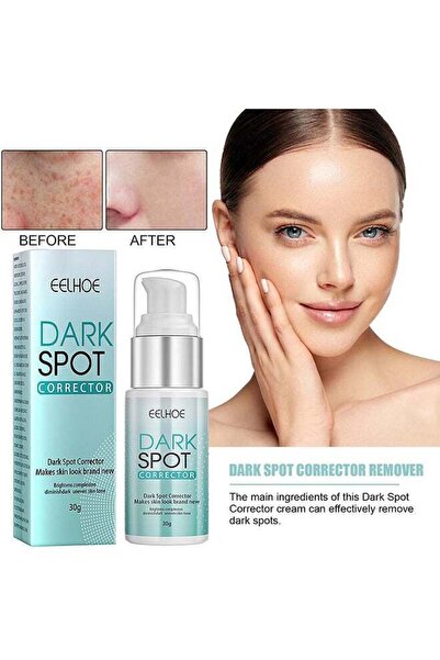 EELHOE Dark Spot Corrector For Face, Fast-Acting Dark Spot Corrector Remover ...