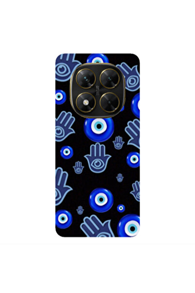 Other Xiaomi Poco X7 Eye in hand Transparent Silicone TPU Θήκη