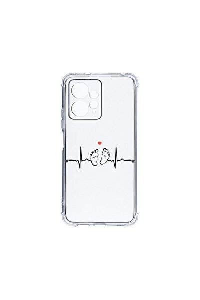bestcase Husa BestCase¬Æ Anti Shock 1.5MM, Compatibila Cu Xiaomi Redmi Note 1...