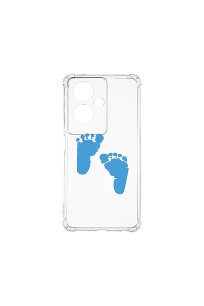 bestcase Αντικραδασμική Θήκη 1.5MM, Συμβατή με OPPO Reno 11F, Σχέδιο Ποδιών Α...