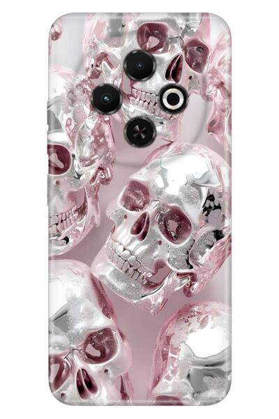 TECNO Spark 30C (KL5n) Kılıf İskelet Pattern Temalı Desenli Darbe Emici Silikon