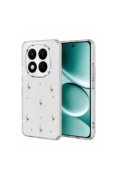 eco port Xiaomi Redmi Note 15 Pro 5g Fiyonk Desenli Kapak - Desen 6 - Desen 6