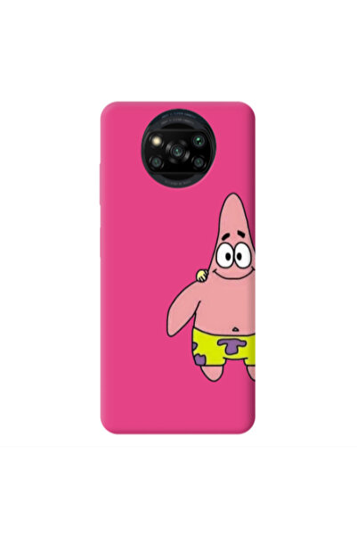 Other Xiaomi Poco X3 /X3 Pro Spong 1 Fuchsia Colored Silicone TPU Θήκη