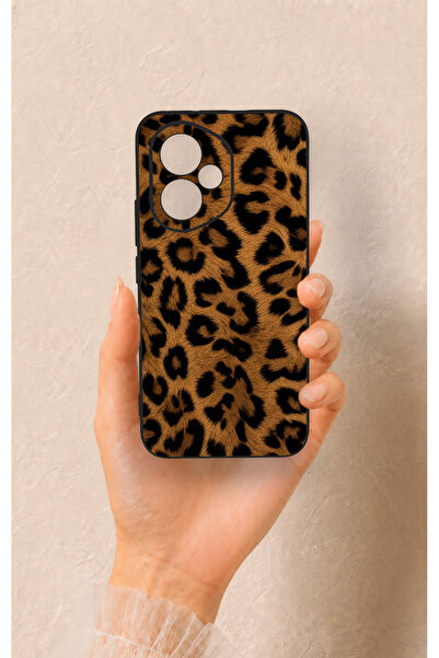 Vip Case Honor 400 Uyumlu Koyu Leopar Deri Desenli Silikon Kılıf