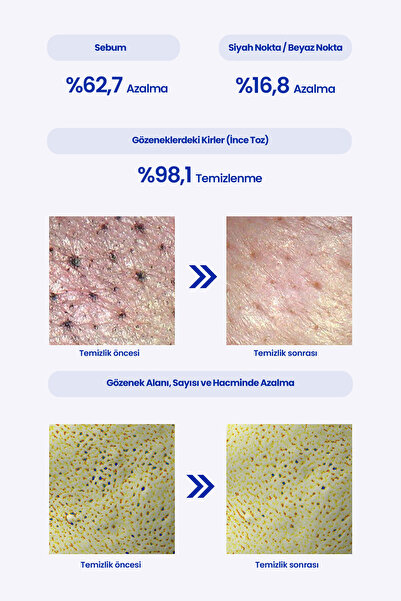 Real Barrier Yağlı His Bırakmayan Gözenek ve Makyaj Temizleme Yağı REALBARRIER Extreme Deep Cleansing Blue Oil