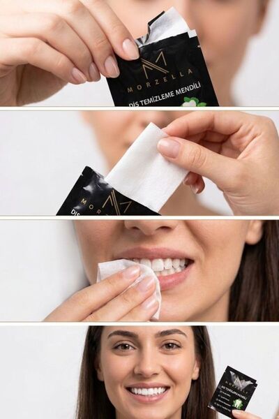 morzella Dental Cleaning and Polishing Care Wipes 12-Pack