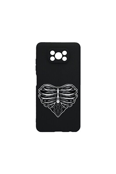 bestcase Husa BestCase¬Æ Slim SIlicon 0.8MM, Compatibila Cu Xiaomi Poco X3, S...
