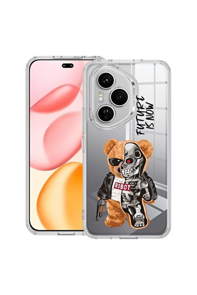 bestcase Прозрачен силиконов калъф за Honor 400 Pro, Наполовина робот, наполо...
