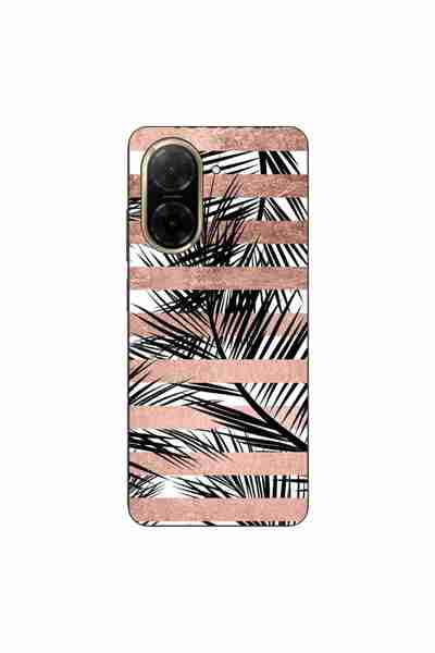 OEM Husa compatibila cu Xiaomi Redmi A5 Silicon Gel Tpu Model Glimmering Noir