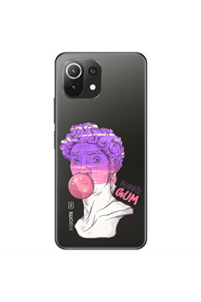 Other Xiaomi Mi 11 Lite Pin Bubble Transparent Silicone TPU Θήκη