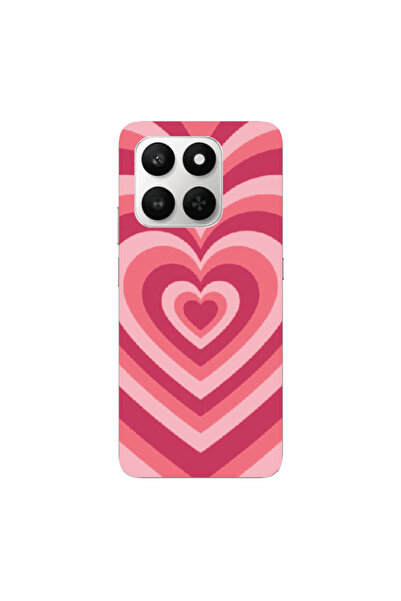 Other Honor Magic 400 Smart Hypnotizing 2 Transparent Silicone TPU Θήκη