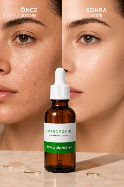 Puredermine Profesyonel %60 Laktik Asit Kimyasal Peeling – Cilt Yenileme, Eks...