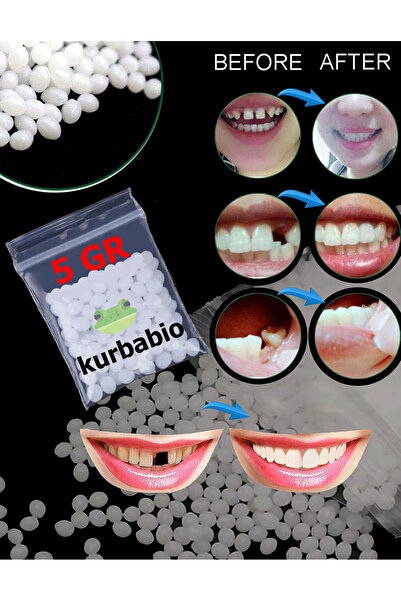 KURBE Pro Thermo Granül 5 Gram Protez Geçici Diş Yapımı, Eksik Diş Giderme, K...