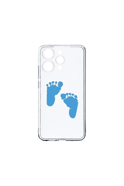 bestcase Husa BestCase¬Æ Clear Silicon 2MM, Compatibila Cu Xiaomi Redmi 12 4G...
