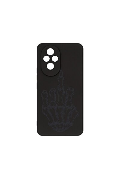 bestcase ¬Æ Husa Premium Silicon, Compatibila Cu Honor 200, Skeleton Hand FU,...