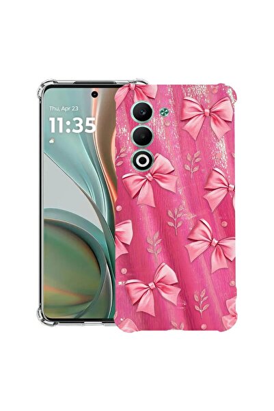 bestcase Αντικραδασμική Θήκη Συμβατή με OPPO A5, Χαριτωμένο Σχέδιο, 2052056 A...